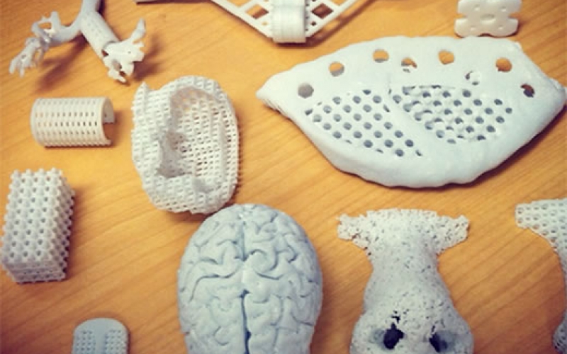In medicine, 3D printers move beyond curiosities thumbnail Photo