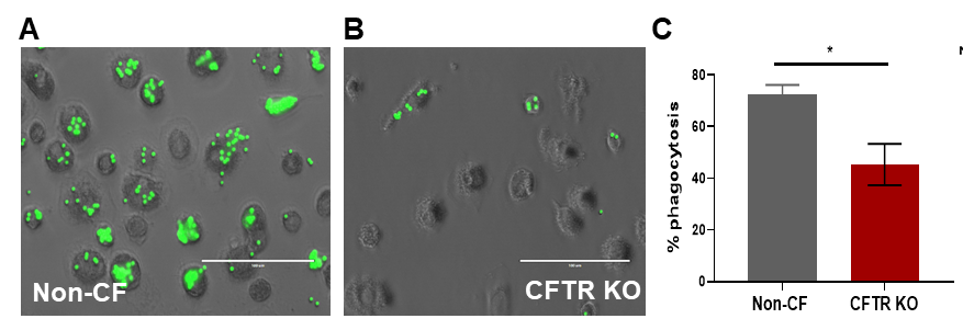 CFTR knockout reveals CFTR-dependent changes Carousel Photo