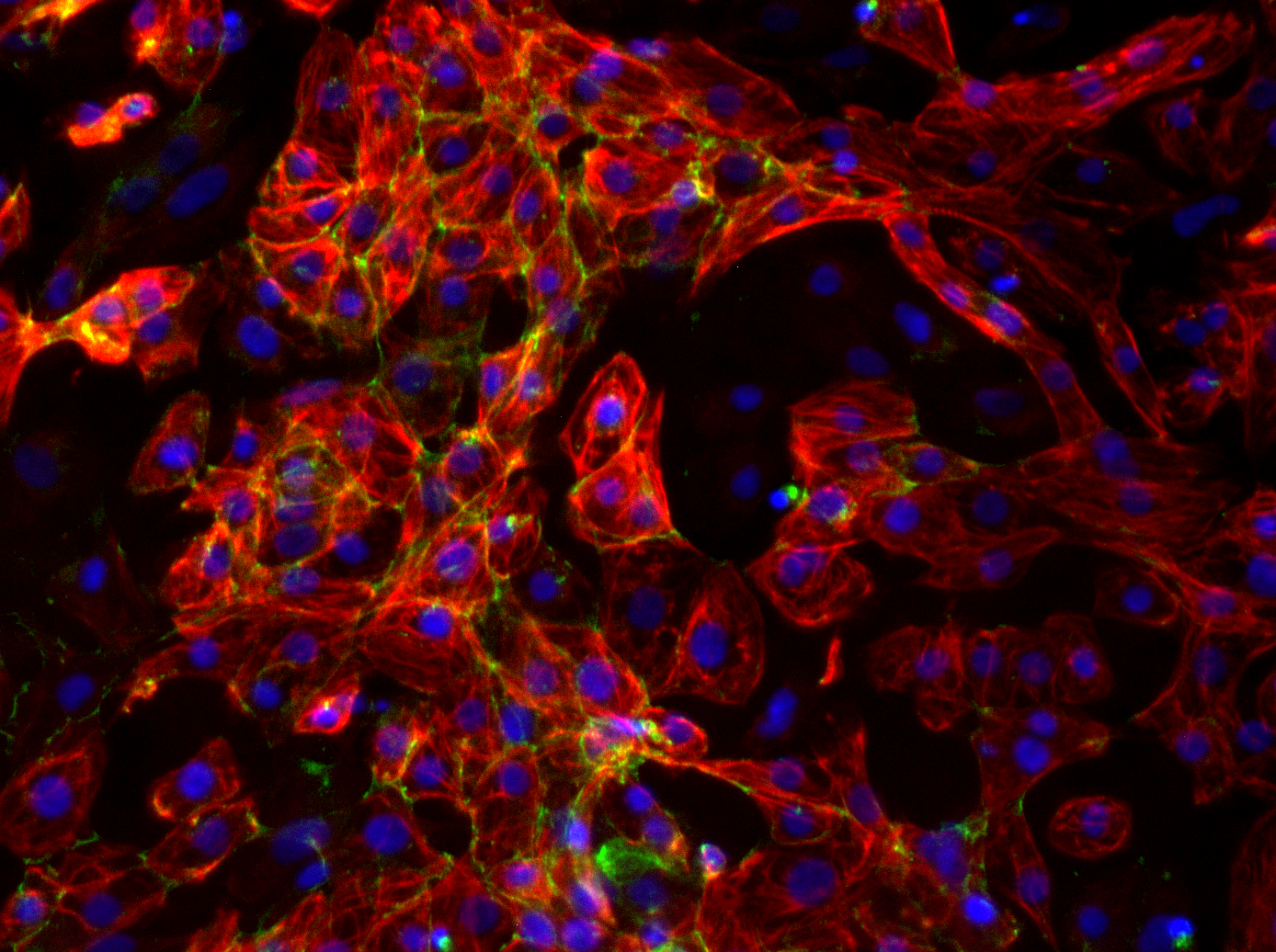 Cardiomyocytes derived from human pluripotent stem cells Carousel Photo